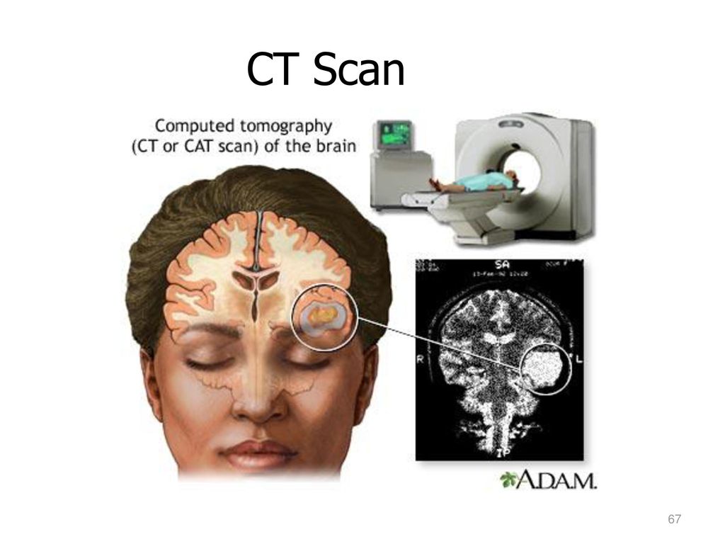 Tomografía axial computarizada como funciona